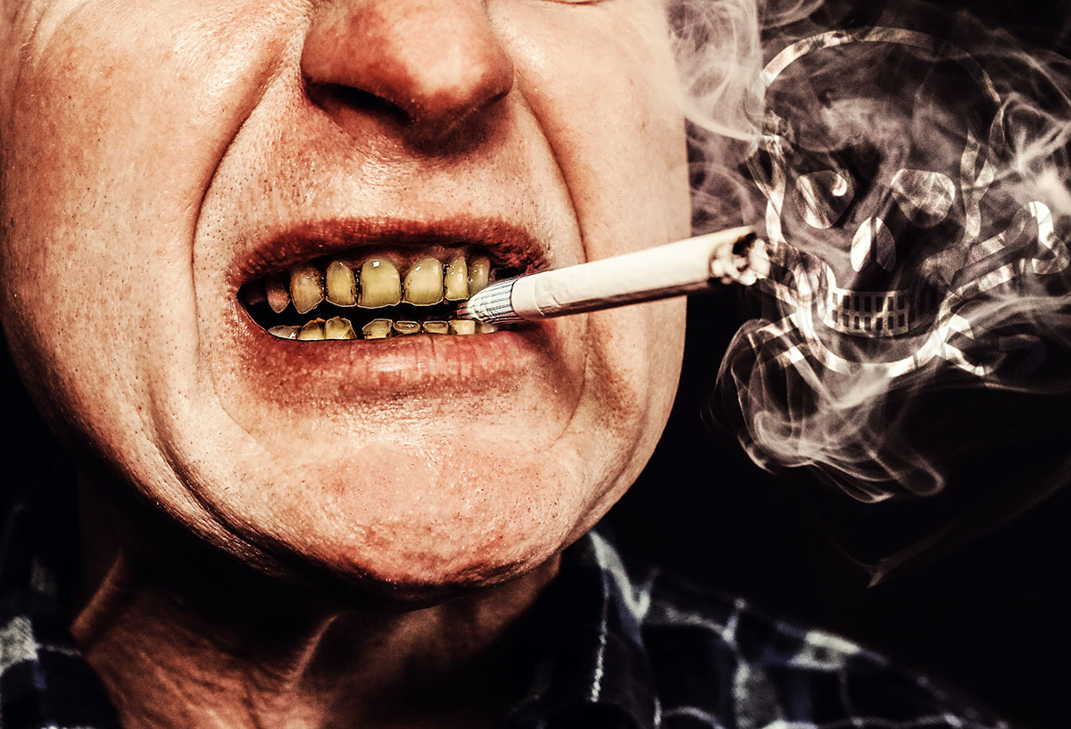 Mies tupakka suussa selvästi värjätytyneiden tai keltaisten hampaiden välissä.